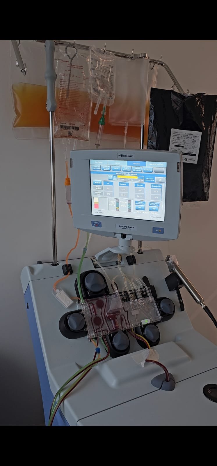 Spectra Optia — Sistema de aféresis Terumo BCT en operación durante TPE