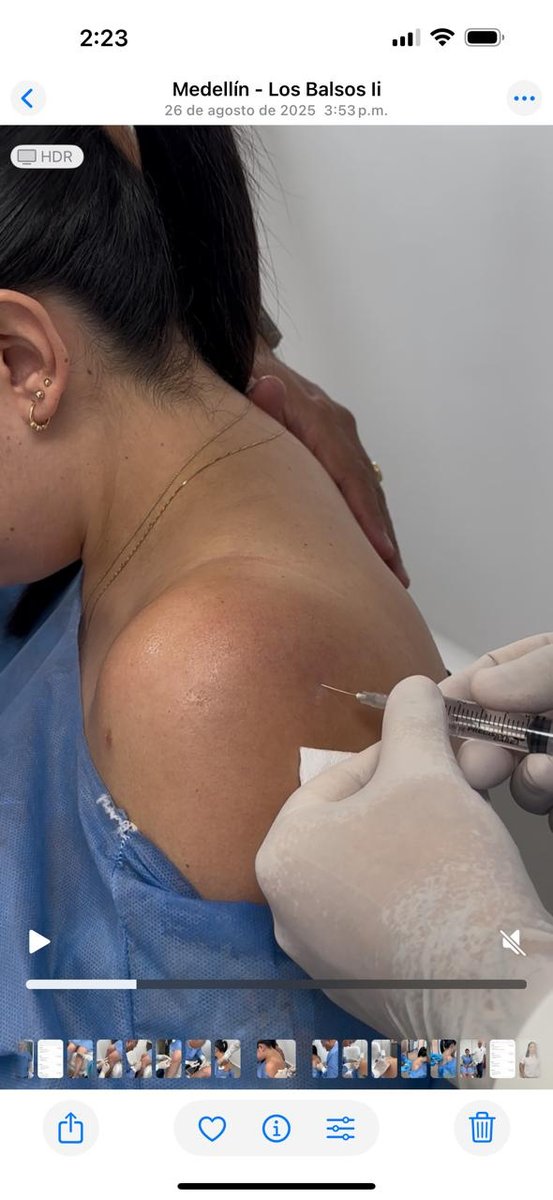 Infiltración regenerativa de hombro aplicada en Wellness Care