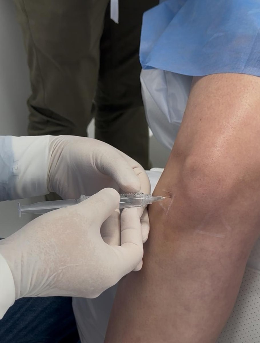 Infiltración regenerativa articular aplicada en Wellness Care