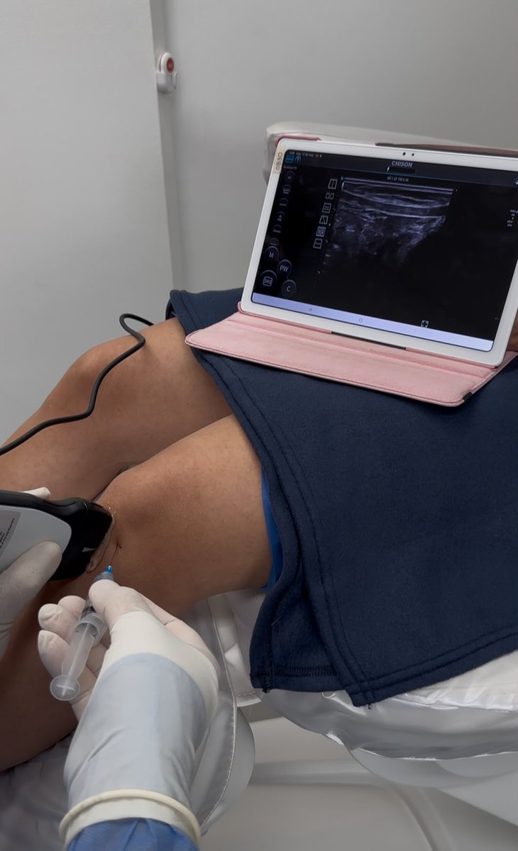 Infiltración regenerativa de rodilla guiada por ecografía en Wellness Care